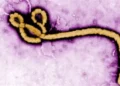 Ebola Death Toll Surpasses 2,000 in DR Congo as Outbreak Spreads Rapidly